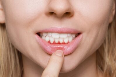 early signs of gum trouble and the best treatments to try