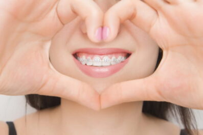 Choosing the Right Orthodontic Treatment for Your Smile