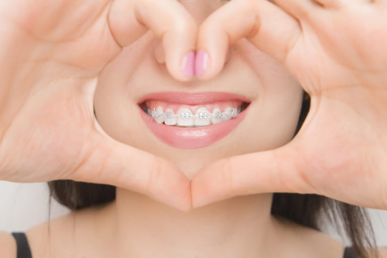 Choosing the Right Orthodontic Treatment for Your Smile